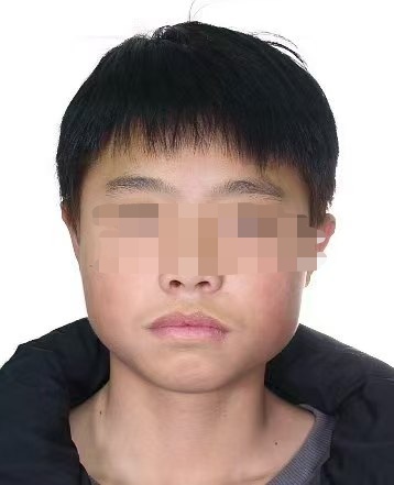 闪电策略 重庆15岁男孩疑似被诱骗 在中越边境检查站附近失联